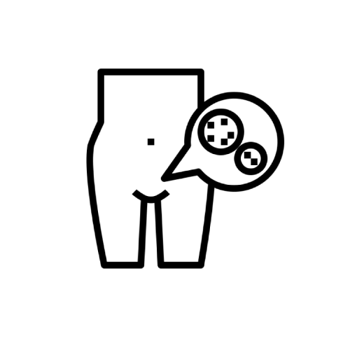 زگیل تناسلی