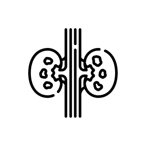 سنگ کلیه