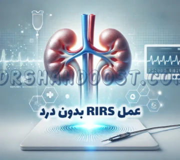 عمل RIRS بدون درد