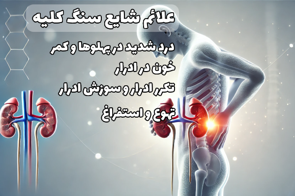 علائم سنگ کلیه 