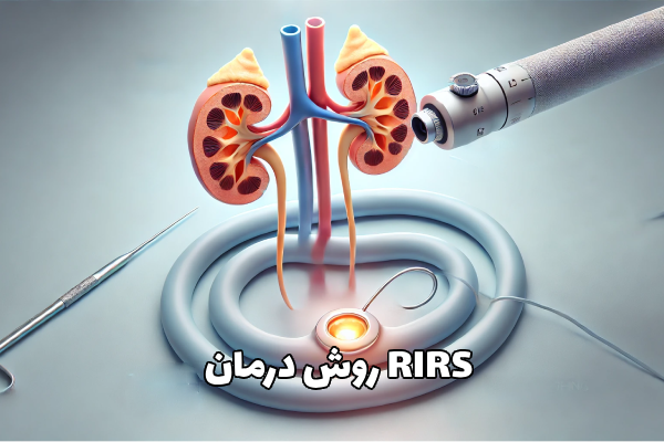 علائم سنگ کلیه