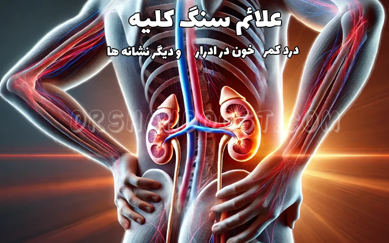 علائم سنگ کلیه