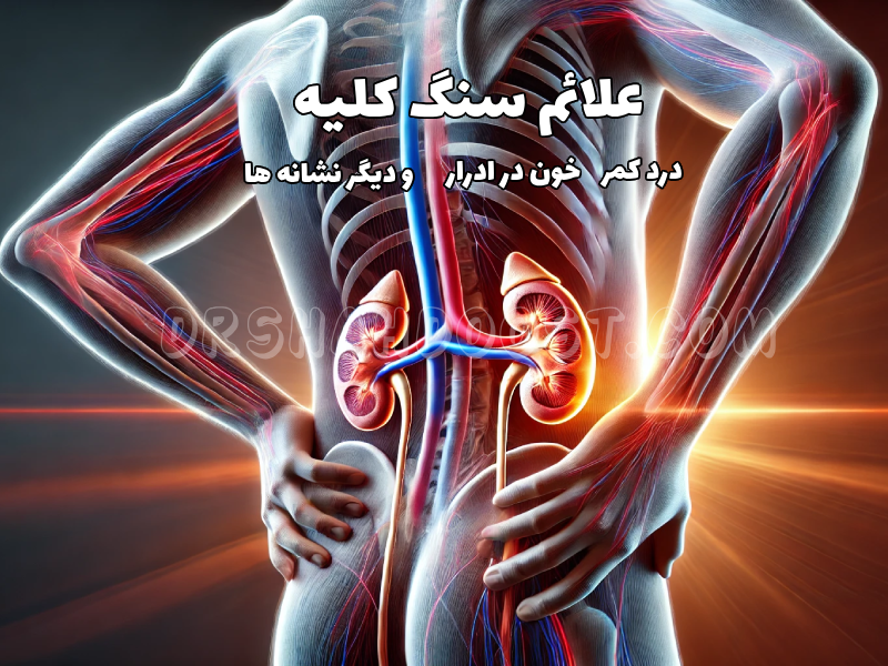 علائم سنگ کلیه