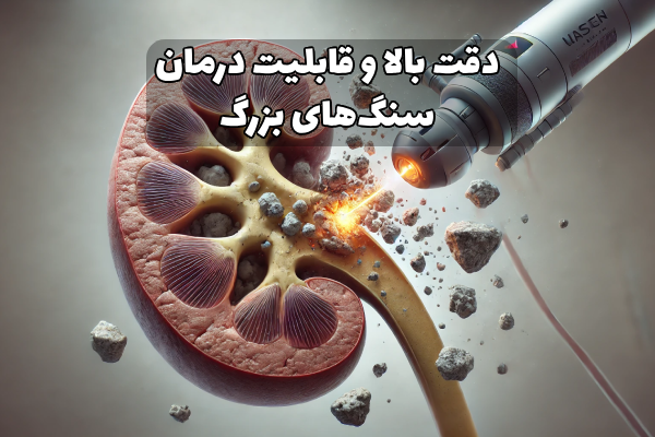 دقت عمل ریرس در ایران