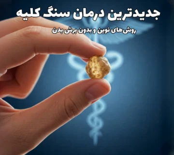 جدیدترین درمان سنگ کلیه