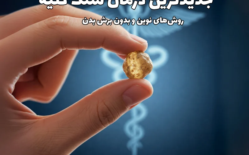 جدیدترین درمان سنگ کلیه