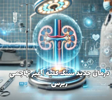 درمان جدید سنگ کلیه
