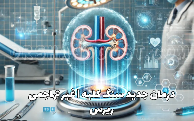 درمان جدید سنگ کلیه