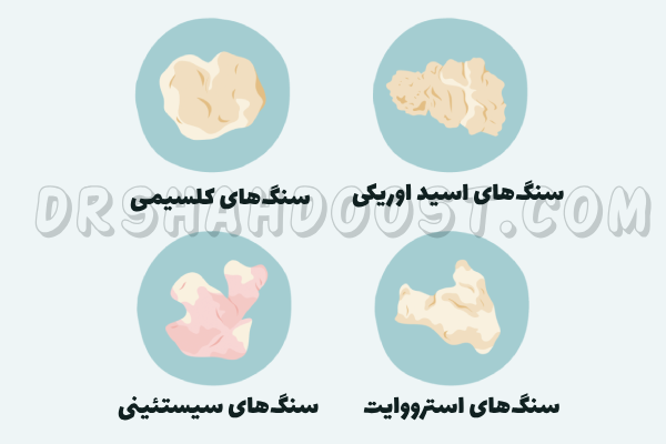 سنگ شکن کلیه