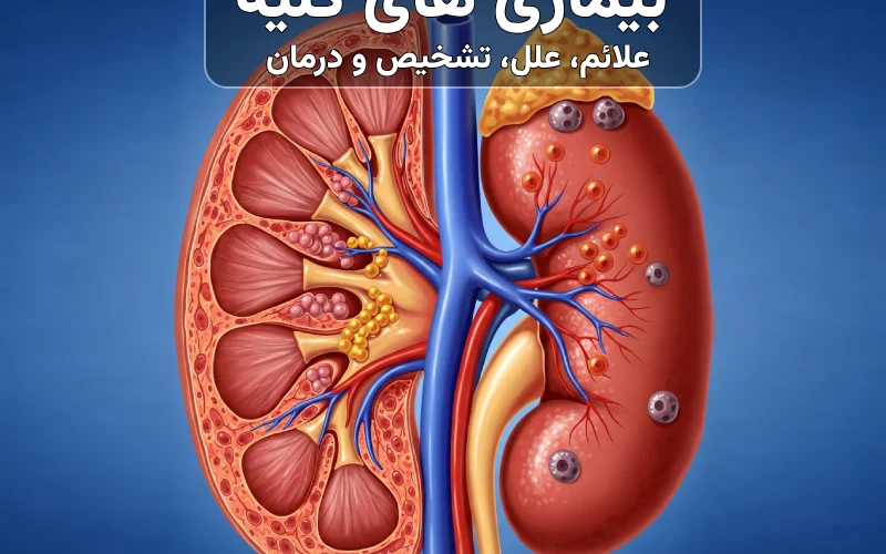 بیماری های کلیه