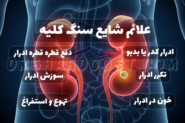 درمان غیر جراحی سنگ کلیه اراک