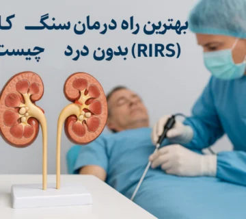 درمان سنگ کلیه بدون درد