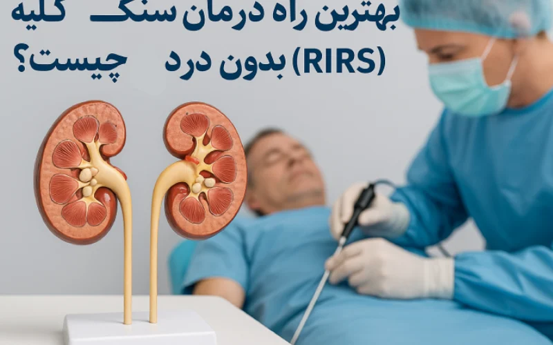 درمان سنگ کلیه بدون درد