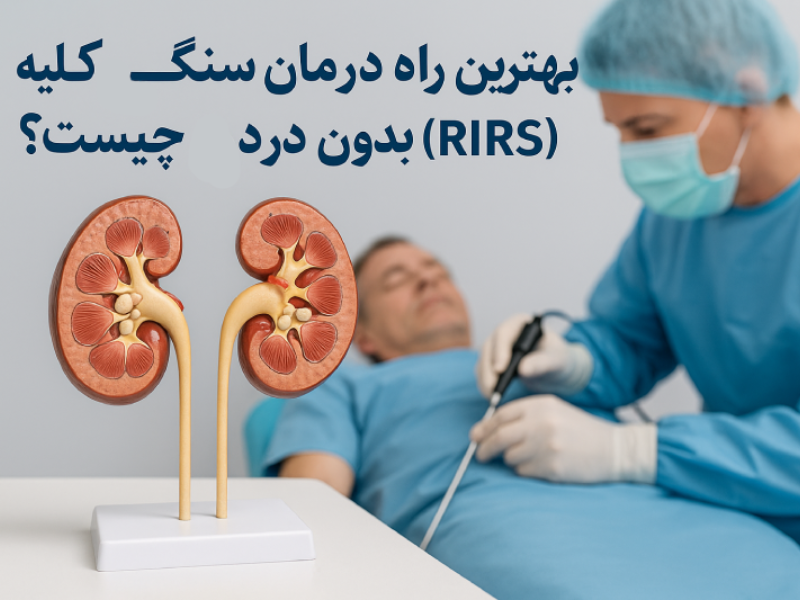 درمان سنگ کلیه بدون درد
