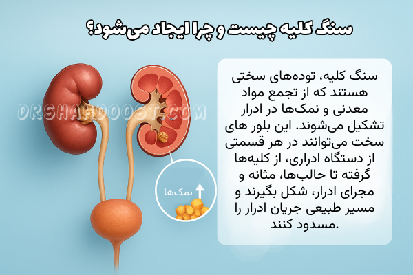 موفق ترین درمان سنگ کلیه