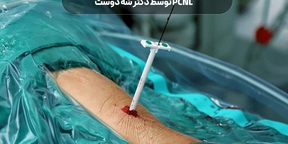 پیشرفته ترین درمان سنگ کلیه