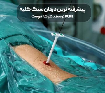 پیشرفته ترین درمان سنگ کلیه