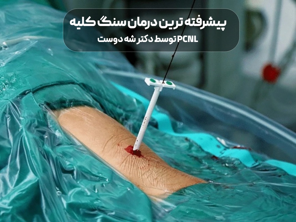 پیشرفته ترین درمان سنگ کلیه