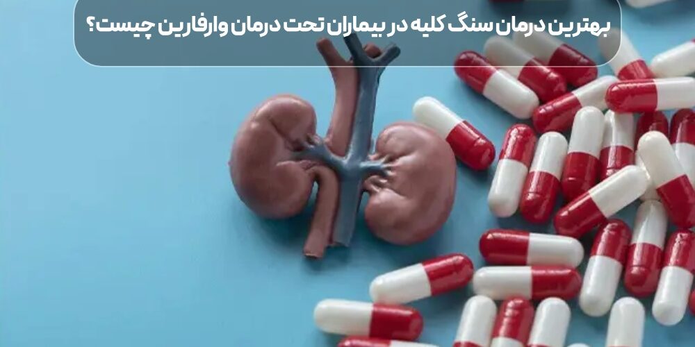 درمان سنگ کلیه در بیماران تحت درمان وارفارین