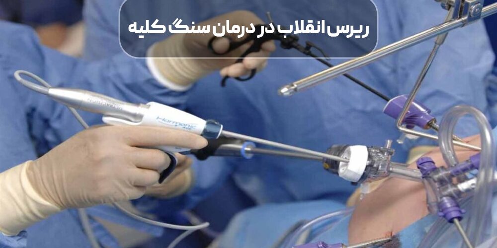 ریرس انقلاب در درمان سنگ کلیه