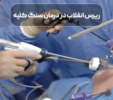 ریرس انقلاب در درمان سنگ کلیه