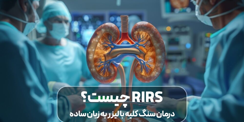 درمان سنگ کلیه با لیزر