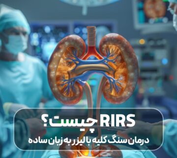 درمان سنگ کلیه با لیزر