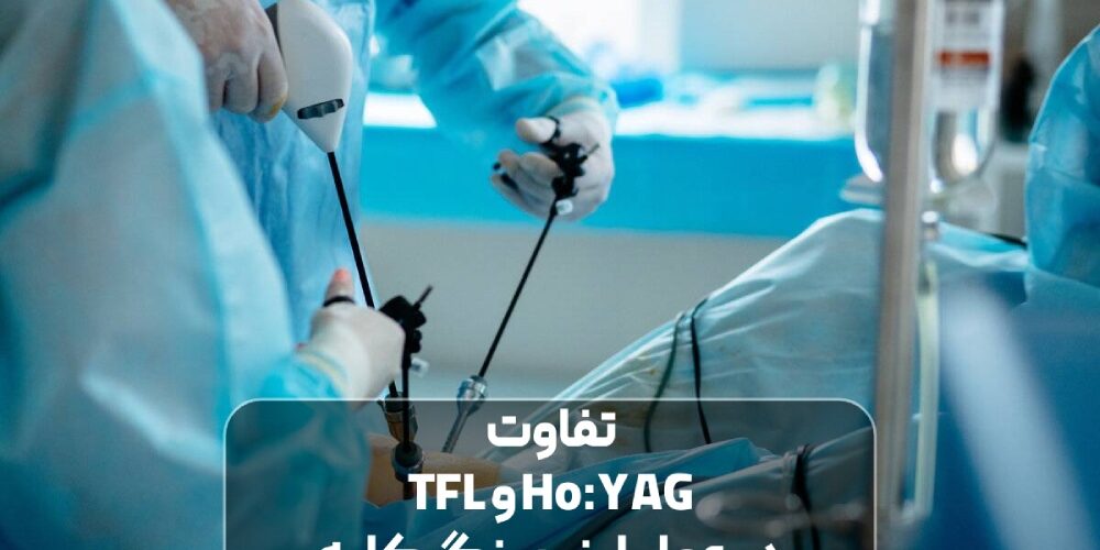 عمل لیزر سنگ کلیه