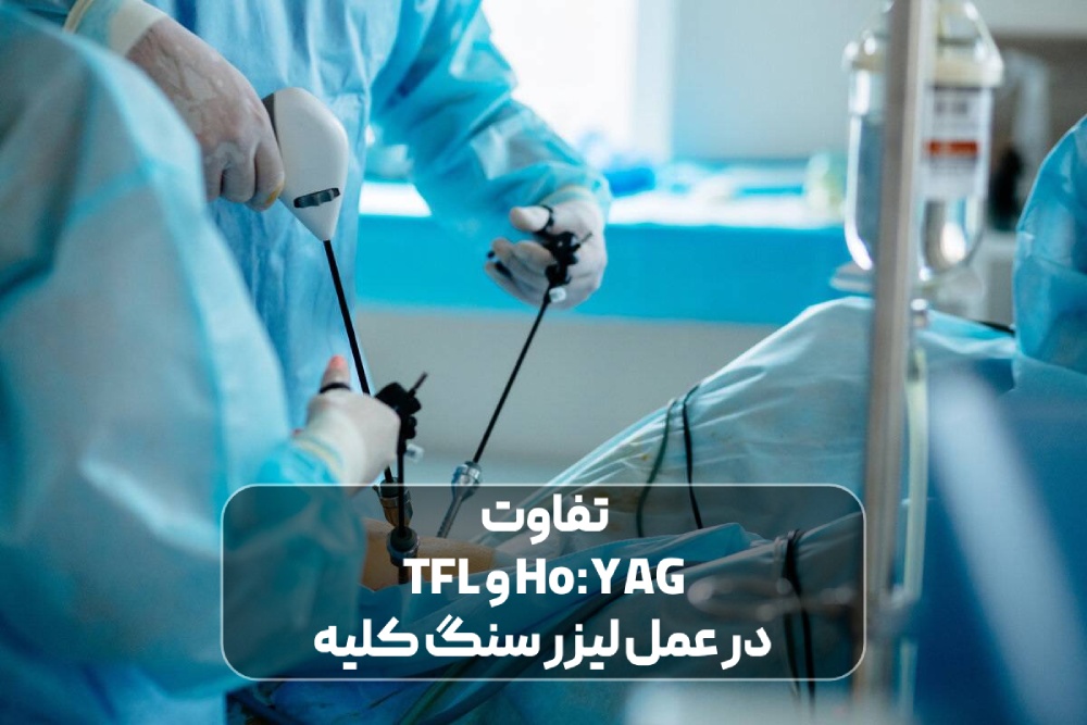 عمل لیزر سنگ کلیه