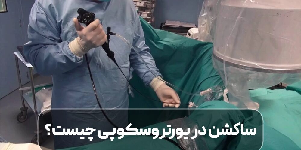 ساکشن در یورتروسکوپی چیست