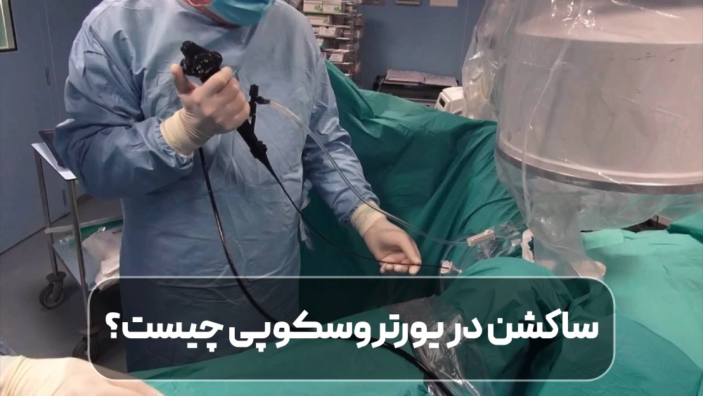 ساکشن در یورتروسکوپی چیست