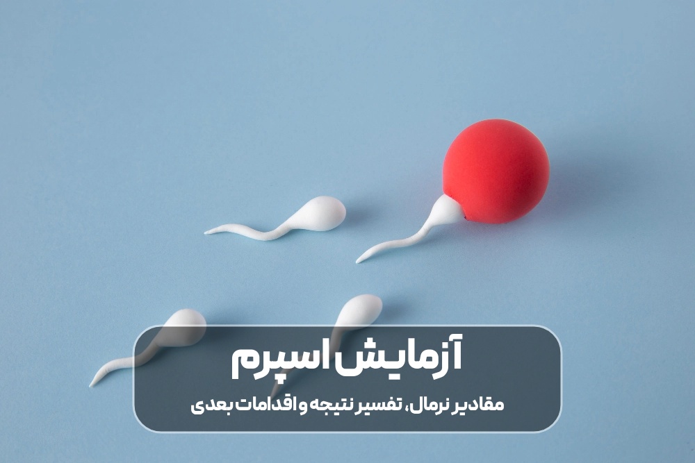آزمایش اسپرم چیست