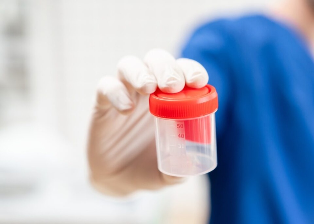 اهمیت آزمایش اسپرم