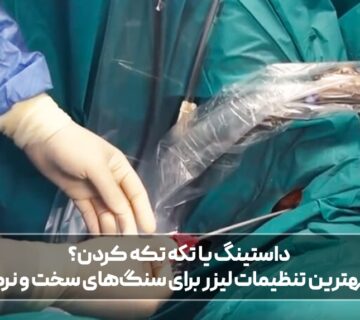 داستینگ یا تکه تکه کردن