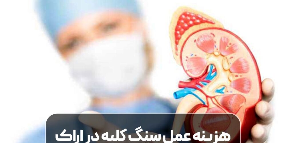 هزینه عمل سنگ کلیه