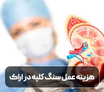 هزینه عمل سنگ کلیه