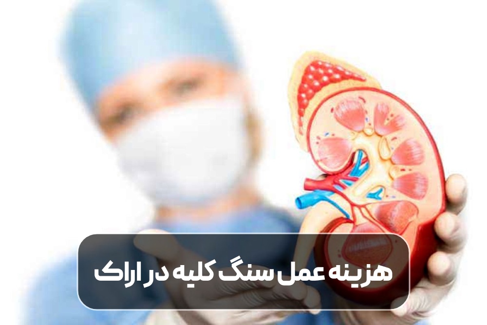 هزینه عمل سنگ کلیه