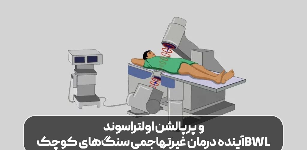 BWL و پرپالشن اولتراسوند