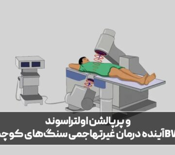 BWL و پرپالشن اولتراسوند