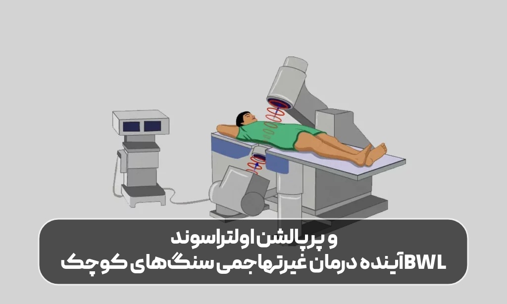 BWL و پرپالشن اولتراسوند