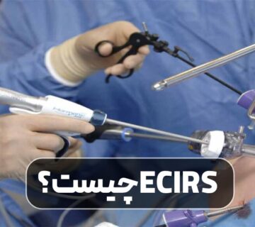 ECIRS چیست