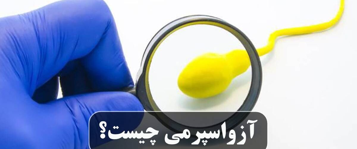 آزواسپرمی چیست