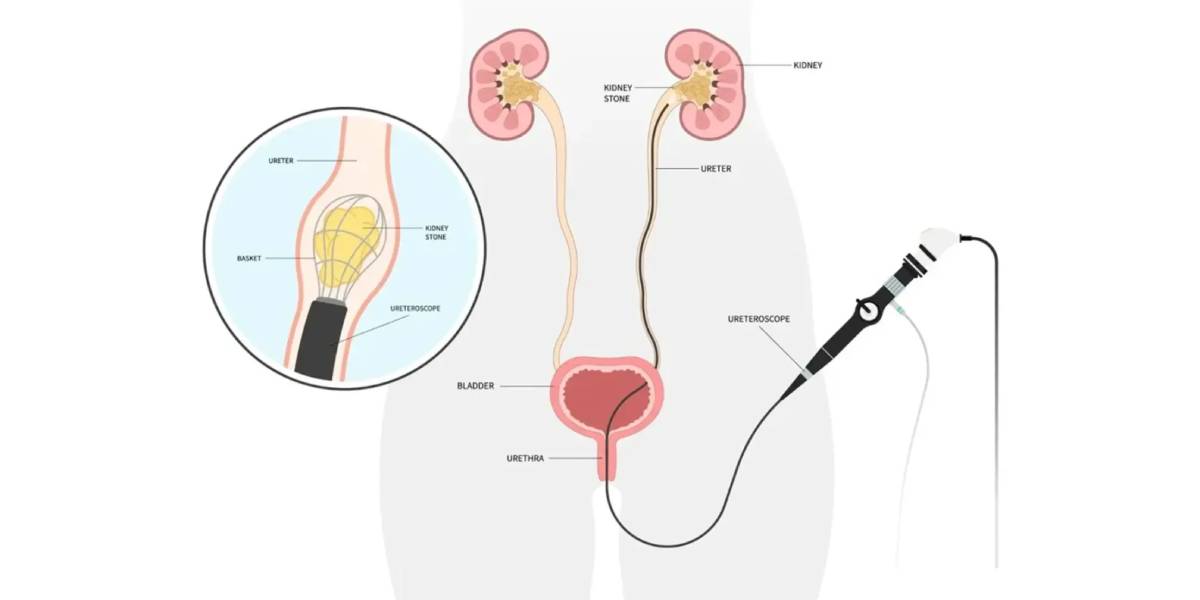 بهترین مرکز پیشرفته ریرس در غرب کشور