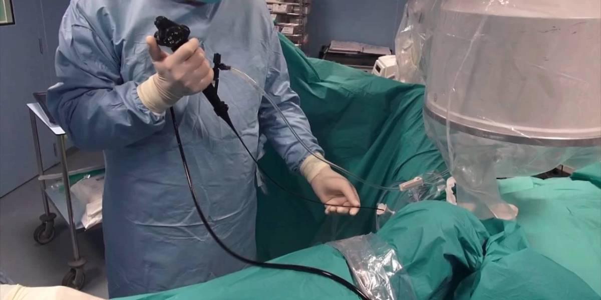 یورتروسکوپی و لیزر سنگ کلیه