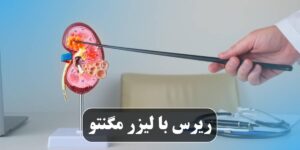 ریرس با لیزر مگنتو