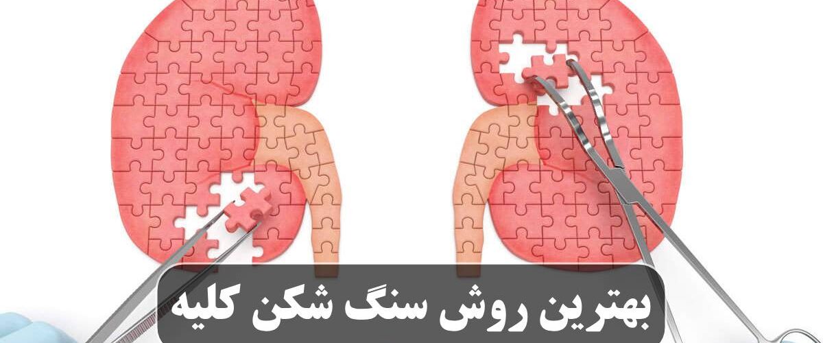 بهترین روش سنگ شکن کلیه