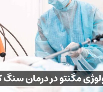 تکنولوژی مگنتو در درمان سنگ کلیه