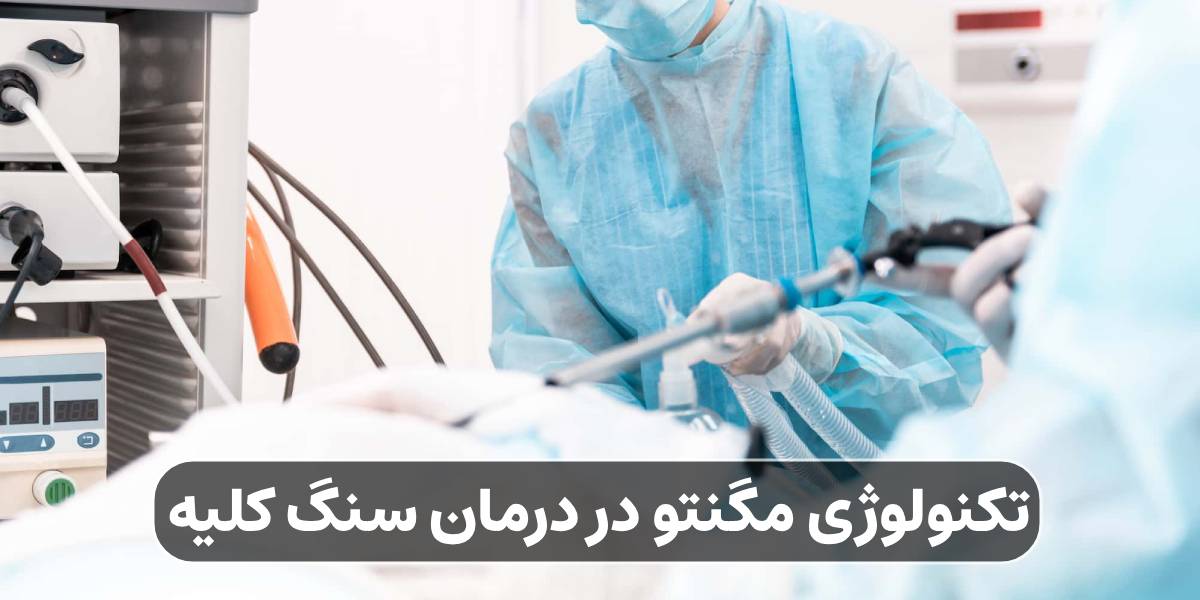 تکنولوژی مگنتو در درمان سنگ کلیه