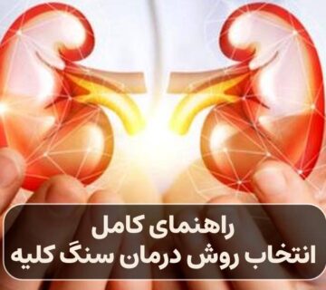 راهنمای انتخاب روش درمان سنگ کلیه
