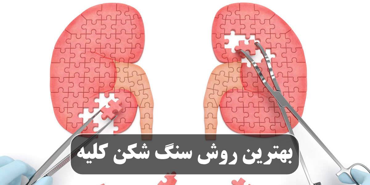 بهترین روش سنگ شکن کلیه